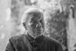 目尻のシワを直す方法は？